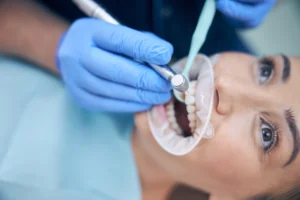 Why Choose Dental Crowns in Long Beach?